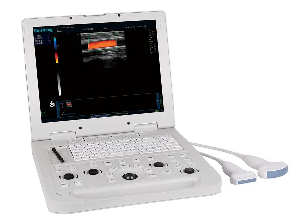 CU3彩色多普勒超声诊断仪