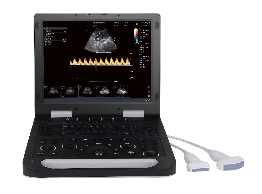 CU5彩色多普勒超声诊断系统